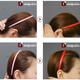 Image for article titled "Round Head" Plastic Surgery Seems Excessive, Even for South Korea